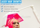 Laser Hair Regrowth